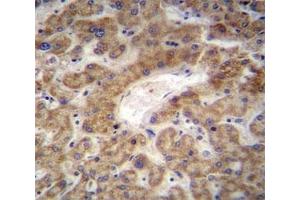 CXCL12 antibody immunohistochemistry analysis in formalin fixed and paraffin embedded human liver tissue.