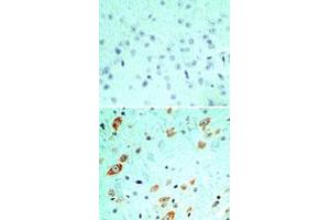 Image no. 1 for anti-Toll-Like Receptor 5 (TLR5) (AA 700-800) antibody (ABIN208231) (TLR5 anticorps  (AA 700-800))