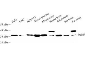 Western blot analysis of tbc1d7 (ABIN7075849) at dilution of 1: 500 (TBC1D7 anticorps)