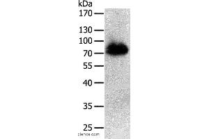 Western blot analysis of Human liver cancer tissue, using PRMT7 Polyclonal Antibody at dilution of 1:500 (PRMT7 anticorps)