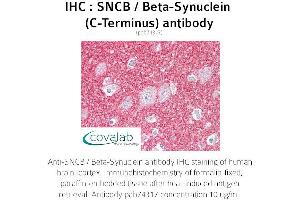 Image no. 1 for anti-Synuclein, beta (SNCB) antibody (ABIN1739479) (beta Synuclein anticorps)