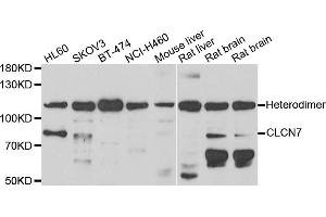 Western blot analysis of extracts of various cell lines, using CLCN7 antibody.