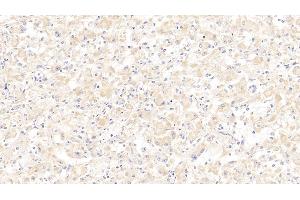 Detection of SCGB2A2 in Human Mammary gland Tissue using Polyclonal Antibody to Secretoglobin Family 2A, Member 2 (SCGB2A2)