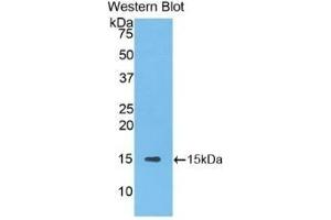 Detection of Recombinant SLC30A8, Human using Polyclonal Antibody to Solute Carrier Family 30 Member 8 (SLC30A8) (SLC30A8 anticorps  (AA 263-369))