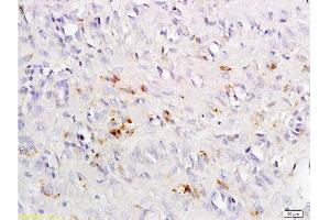 Formalin-fixed and paraffin embedded rat exfoliated cells tissue labeled with Anti-CCR4 Polyclonal Antibody, Unconjugated  at 1:200 followed by conjugation to the secondary antibody and DAB staining