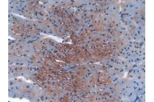 IHC-P analysis of Mouse Heart Tissue, with DAB staining. (IGF2R anticorps  (AA 1148-1365))