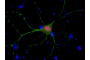 Indirect immunostaining of PFA fixed rat hippocampus neurons with anti-Ctip 2 (dilution 1 : 500; red) and mouse anti-MAP 2 (, dilution 1 : 500; green).