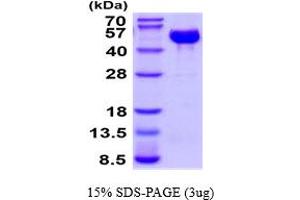 SDS-PAGE (SDS) image for Tumor Necrosis Factor Receptor Superfamily, Member 18 (TNFRSF18) (AA 26-162) protein (hIgG-His-tag) (ABIN5854537)