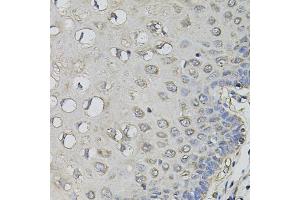 Immunohistochemistry of paraffin-embedded human esophagus using AMPD1 antibody (ABIN5995393) (40x lens). (AMPD1 anticorps)