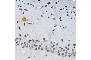 Immunohistochemistry of paraffin-embedded mouse brain using BIRC7 antibody. (BIRC7 anticorps)