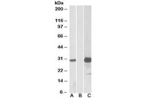 Western blot testing of HEK293 lysate overexpressing human KCTD11-FLAG with KCTD11 antibody (1ug/ml) in lane A and anti-FLAG (1/5000) in lane C. (KCTD11 anticorps)