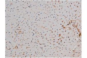 ABIN6267437 at 1/200 staining Mouse heart tissue sections by IHC-P. (RPS6KB1 anticorps  (pThr229))