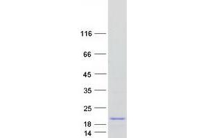 Validation with Western Blot