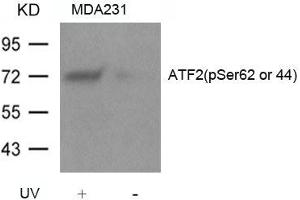 Western blot analysis of extracts from MDA231 cells untreated or treated with UV using ATF2(Phospho-Ser62 or 44) Antibody. (ATF2 anticorps  (pSer62))