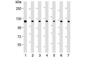 Western blot testing of human 1) HeLa, 2) HT-29, 3) Jurkat, 4) MOLT4, 5) PC-3, 6) 293 and 7) COLO205 cell lysate with TERT antibody. (TERT anticorps  (AA 627-656))