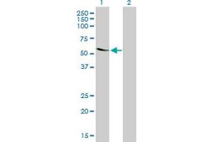 Western Blot analysis of TROVE2 expression in transfected 293T cell line by TROVE2 monoclonal antibody (M03), clone 1F2.