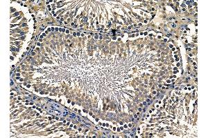 ABIN7095333 and ABIN7099390 at 1/100 staining rat testis tissue by IHC-P. (COPA anticorps)