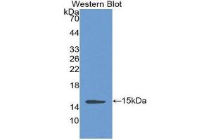 Western Blotting (WB) image for anti-Complement Factor B (CFB) (AA 270-388) antibody (ABIN1858371) (Complement Factor B anticorps  (AA 270-388))