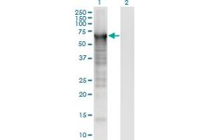 Western Blot analysis of PLS3 expression in transfected 293T cell line by PLS3 monoclonal antibody (M01), clone 5B9. (Plastin 3 anticorps  (AA 1-630))