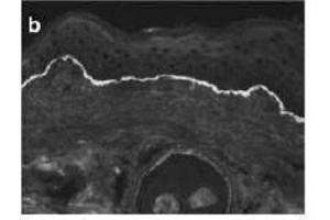 Immunofluorescence of Collagen VII staining of Cryosections of Murine Skin.
