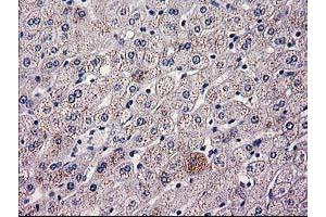 Immunohistochemical staining of paraffin-embedded Human liver tissue using anti-HAO1 mouse monoclonal antibody. (HAO1 anticorps)