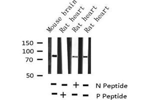 Western blot analysis of Phospho-PKC alpha (Thr638) expression in various lysates