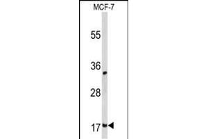 Western blot analysis of DSTN Antibody (Center) (ABIN653136 and ABIN2842712) in MCF-7 cell line lysates (35 μg/lane). (Destrin anticorps  (AA 70-98))