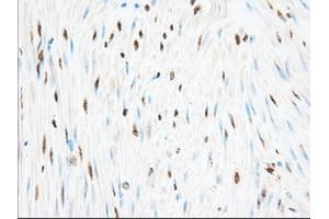 Immunohistochemical staining of paraffin-embedded Human pancreas tissue using anti-H6PD mouse monoclonal antibody. (Glucose-6-Phosphate Dehydrogenase anticorps)