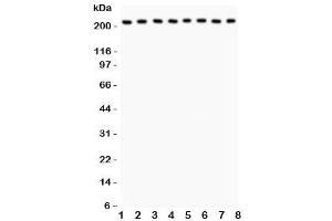 Western blot testing of Integrin alpha 5 antibody and Lane 1:  rat brain (ITGA5 anticorps  (AA 787-992))