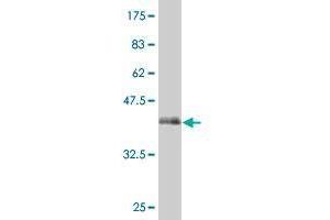 Western Blot detection against Immunogen (37.