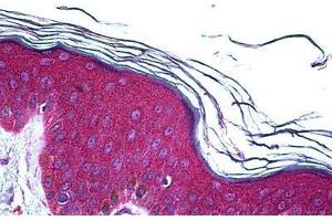 Human Skin: Formalin-Fixed, Paraffin-Embedded (FFPE)