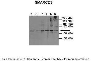 Host:  Rabbit  Target Name:  SMARCD3  Sample Type:  Human Fetal Brain  Antibody Dilution:  1. (SMARCD3 anticorps  (N-Term))