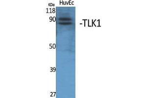Western Blotting (WB) image for anti-Tousled-Like Kinase 1 (TLK1) (Internal Region) antibody (ABIN3187282)