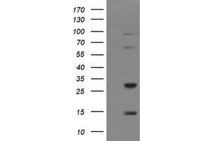 Image no. 2 for anti-Tripartite Motif Containing 38 (TRIM38) (AA 1-265) antibody (ABIN1490686) (TRIM38 anticorps  (AA 1-265))