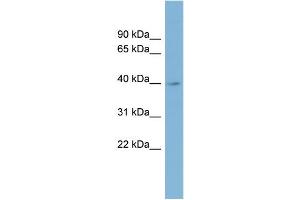 WB Suggested Anti-IMPAD1 Antibody Titration:  0. (IMPAD1 anticorps  (Middle Region))