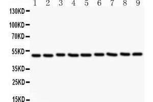 Anti-CSK Picoband antibody, All lanes: Anti CSK  at 0. (CSK anticorps  (AA 2-204))