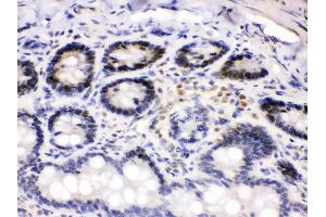 Anti- Cdk4 Picoband antibody, IHC(P) IHC(P): Rat Intestine Tissue