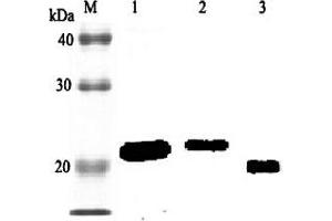 Western blot analysis using anti-RBP4 (rat), pAb  at 1:2'000 dilution. (RBP4 anticorps)