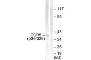 Western blot analysis of extracts from Jurkat cells, using CCR5 (Phospho-Ser336) Antibody. (CCR5 anticorps  (pSer336))