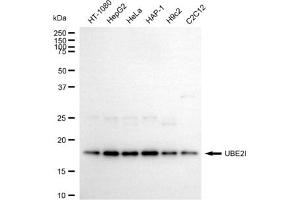 Western blotting analysis using UBE2I antibody (ABIN7800746).