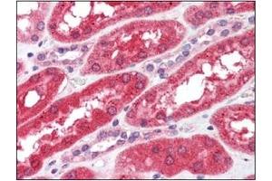 Immunohistochemistry (IHC) image for anti-Fibroblast Growth Factor Receptor 4 (FGFR4) antibody (ABIN356413)