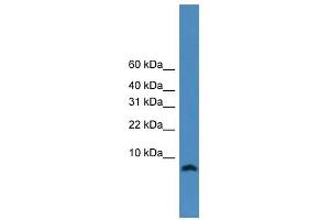 WB Suggested Anti-KIAA0101 Antibody Titration:  0. (KIAA0101 anticorps  (N-Term))