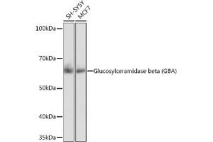 Western blot analysis of extracts of various cell lines, using Glucosylceramidase beta (Glucosylceramidase beta (GBA)) antibody (ABIN7267407) at 1:1000 dilution. (GBA anticorps)
