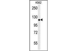 Western blot analysis of POTEE Antibody (Center) in K562 cell line lysates (35ug/lane). (POTEE anticorps  (Middle Region))
