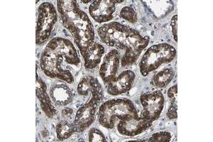 Immunohistochemical staining of human kidney with KIAA1958 polyclonal antibody  shows strong cytoplasmic positivity tubular cells. (KIAA1958 anticorps)