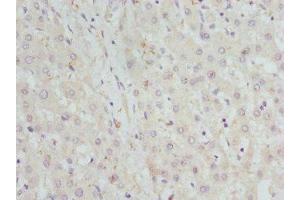 Immunohistochemistry of paraffin-embedded human liver tissue using ABIN7142066 at dilution of 1:100