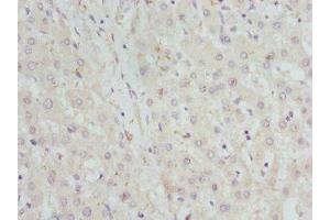 Immunohistochemistry of paraffin-embedded human liver tissue using ABIN7142066 at dilution of 1:100 (GBE1 anticorps  (AA 1-300))