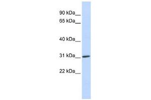 ARD1A antibody used at 1 ug/ml to detect target protein. (NAA10 anticorps)