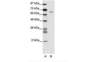 Image no. 1 for anti-Zinc Finger Protein 205 (ZNF205) (AA 31-80) antibody (ABIN202754) (ZNF205 anticorps  (AA 31-80))