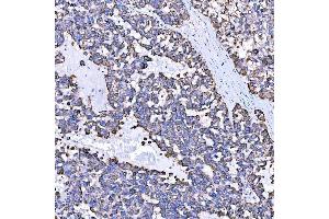 IHC analysis of SUMF2 using anti-SUMF2 antibody (ABIN7600954).